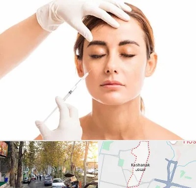 تزریق ژل گونه در کاشانک