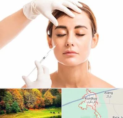 تزریق ژل گونه در کردکوی