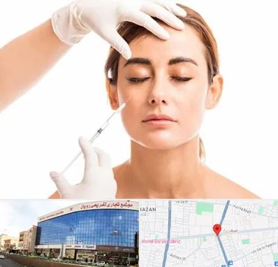 تزریق ژل گونه در نصف راه تبریز