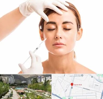 تزریق ژل گونه در بلوار تعاون