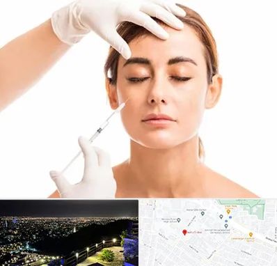 تزریق ژل گونه در هفت تیر مشهد