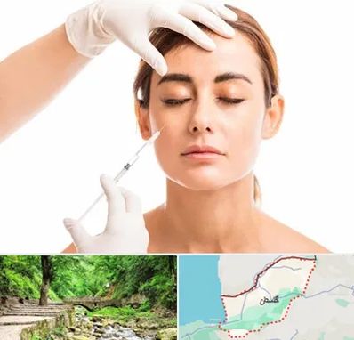 تزریق ژل گونه در گلستان
