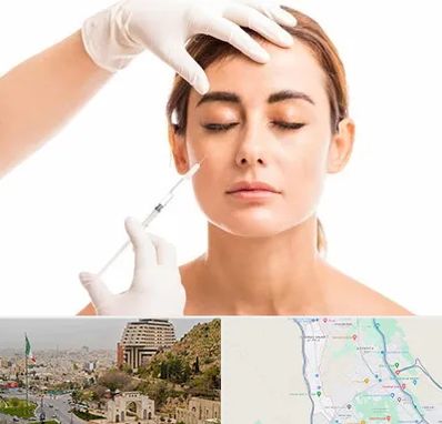 تزریق ژل گونه در فرهنگ شهر شیراز