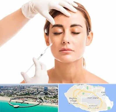 تزریق ژل گونه در کیش