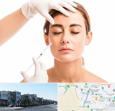 تزریق ژل گونه در شریعتی مشهد