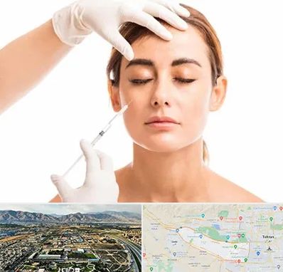 تزریق ژل گونه در منطقه 21 تهران