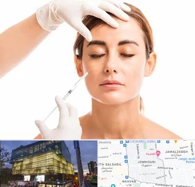 تزریق ژل گونه در جمهوری