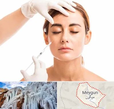 تزریق ژل گونه در میگون