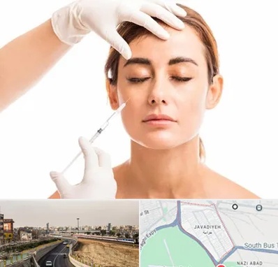 تزریق ژل گونه در جوادیه