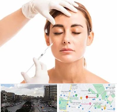 تزریق ژل گونه در بلوار فردوسی مشهد