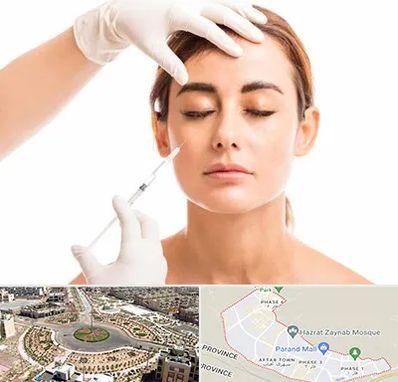 تزریق ژل گونه در پرند