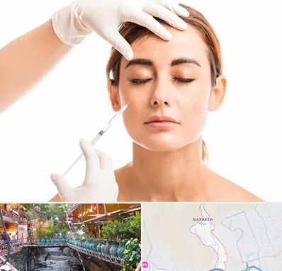 تزریق ژل گونه در درکه