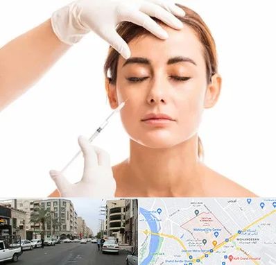 تزریق ژل گونه در زیتون کارمندی اهواز