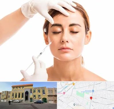 تزریق ژل گونه در زنبیل آباد قم