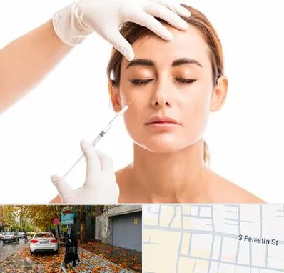 تزریق ژل گونه در خیابان فلسطین