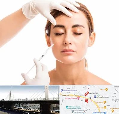 تزریق ژل گونه در پارک وی