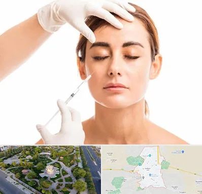 تزریق ژل گونه در کاشمر