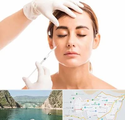 تزریق ژل گونه در ایلام