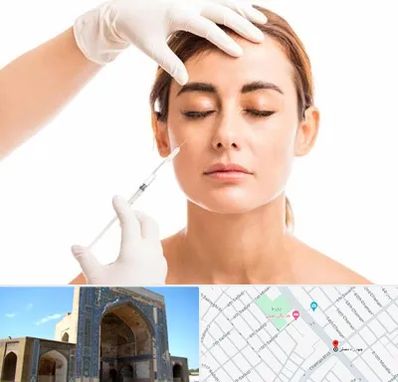 تزریق ژل گونه در مصلی مشهد