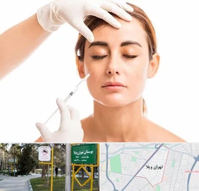 تزریق ژل گونه در تهران ویلا