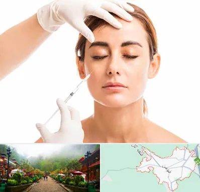تزریق ژل گونه در فومن