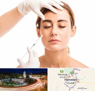 تزریق ژل گونه در همدان