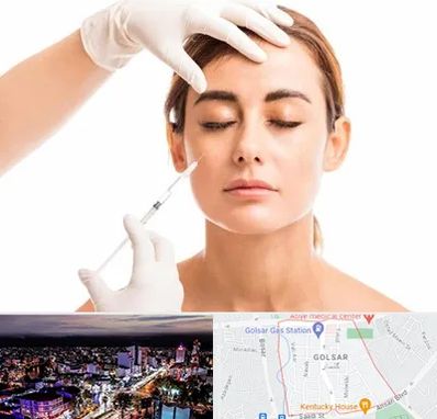 تزریق ژل گونه در گلسار رشت