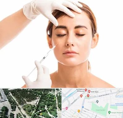 تزریق ژل گونه در سالاریه قم