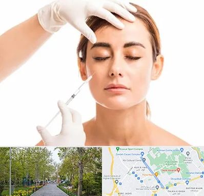 تزریق ژل گونه در قدوسی غربی شیراز