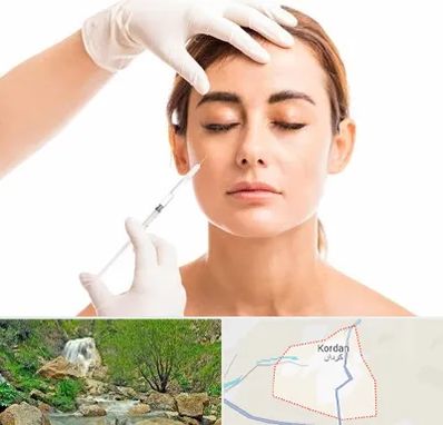 تزریق ژل گونه در کردان