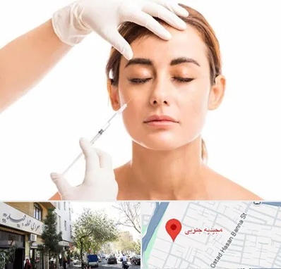 تزریق ژل گونه در مجیدیه جنوبی