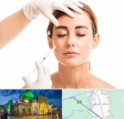 تزریق ژل گونه در آستانه اشرفیه