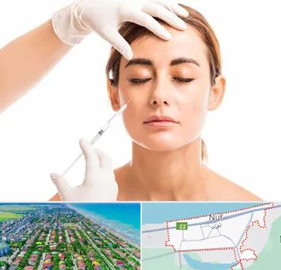 تزریق ژل گونه در نور