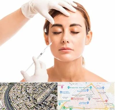 تزریق ژل گونه در شهرک غرب مشهد