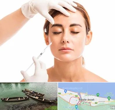 تزریق ژل گونه در بندر انزلی