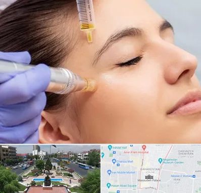 میکرونیدلینگ در بهارستان