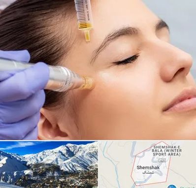 میکرونیدلینگ در شمشک