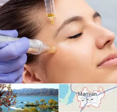 میکرونیدلینگ در مریوان