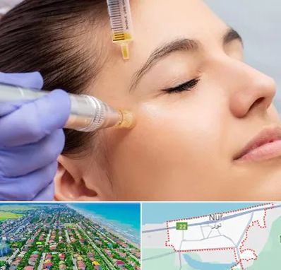 میکرونیدلینگ در نور