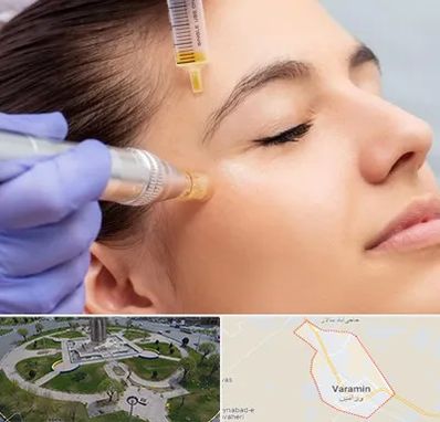 میکرونیدلینگ در ورامین