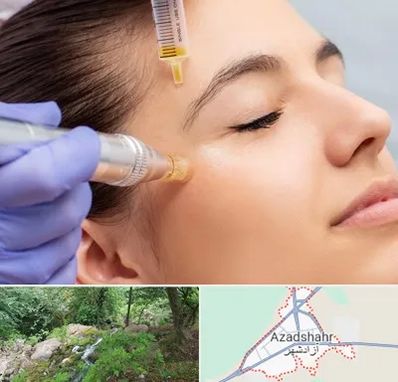 میکرونیدلینگ در آزادشهر