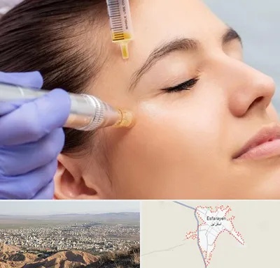 میکرونیدلینگ در اسفراین