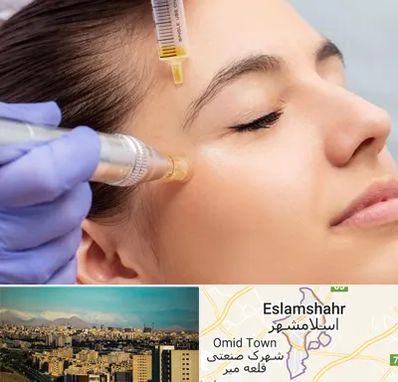 میکرونیدلینگ در اسلامشهر