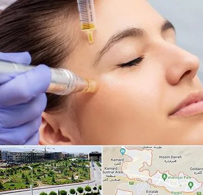 میکرونیدلینگ در پردیس