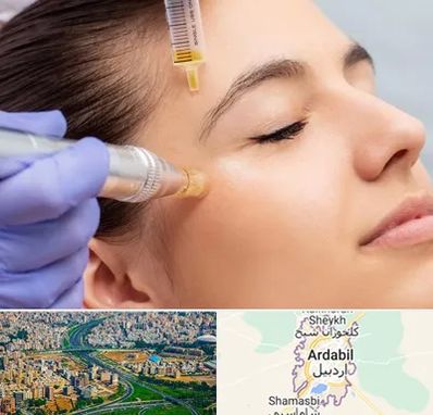 میکرونیدلینگ در اردبیل