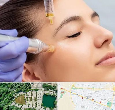 میکرونیدلینگ در وکیل آباد مشهد