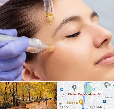 میکرونیدلینگ در چهارباغ اصفهان