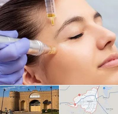 میکرونیدلینگ در ایرانشهر