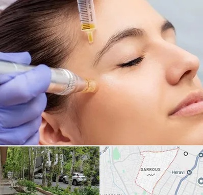 میکرونیدلینگ در دروس