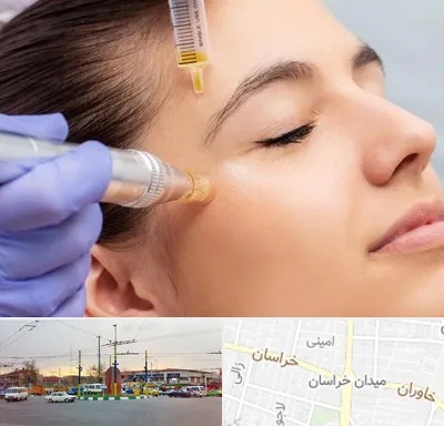 میکرونیدلینگ در میدان خراسان